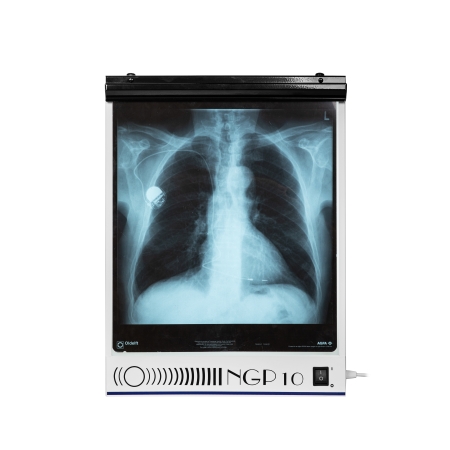 Negatoskop jednoklatkowy NGP 10 hf